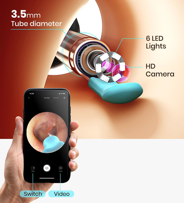 SmartEar Cleaner : HD vision with WIFI Connectivity