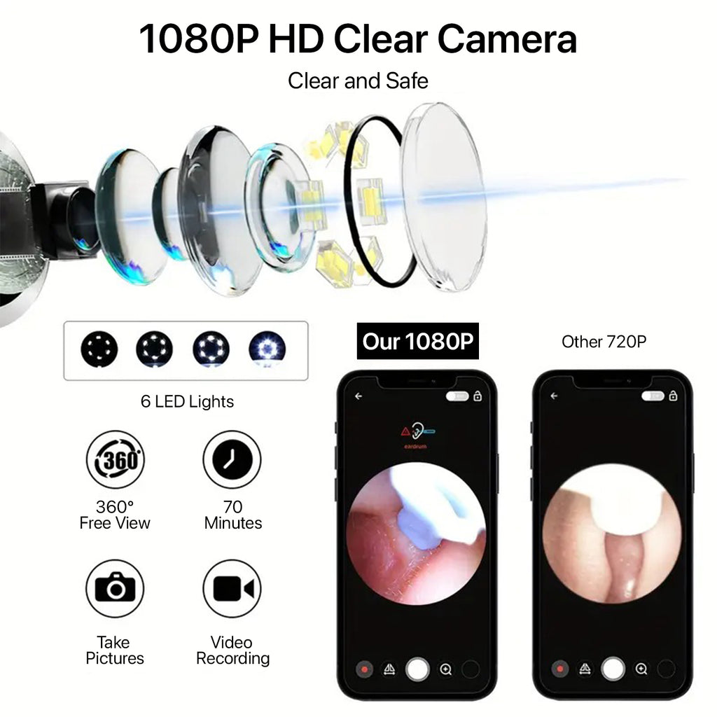 SmartEar Cleaner : HD vision with WIFI Connectivity
